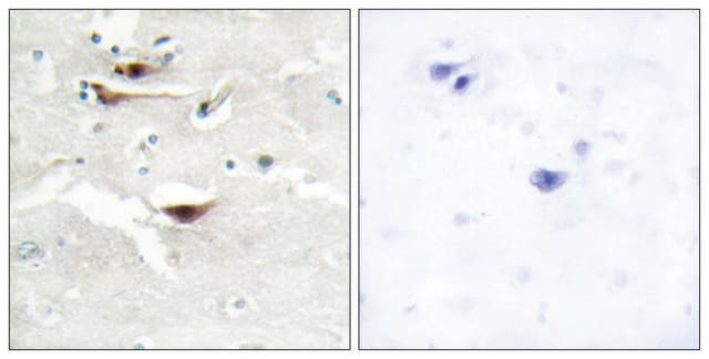 Anti-IPPK, N-Terminal antibody produced in rabbit affinity isolated antibody