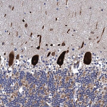 Anti-FAM214A antibody produced in rabbit Prestige Antibodies&#174; Powered by Atlas Antibodies, affinity isolated antibody, buffered aqueous glycerol solution