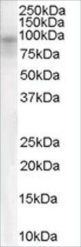 Anti-Dipeptidylpeptidase 10 antibody produced in goat affinity isolated antibody, buffered aqueous solution