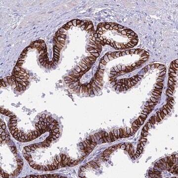 Anti-OR1Q1 antibody produced in rabbit Prestige Antibodies&#174; Powered by Atlas Antibodies, affinity isolated antibody, buffered aqueous glycerol solution