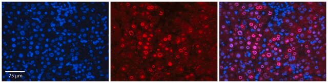 Anti-FOS antibody produced in rabbit affinity isolated antibody