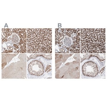 Anti-ABCD3 antibody produced in rabbit Prestige Antibodies&#174; Powered by Atlas Antibodies, affinity isolated antibody, buffered aqueous glycerol solution