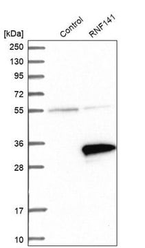 Anti-RNF141 antibody produced in rabbit Prestige Antibodies&#174; Powered by Atlas Antibodies, affinity isolated antibody, buffered aqueous glycerol solution