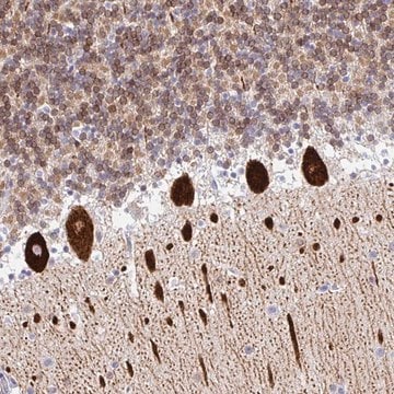 Anti-TP53I11 antibody produced in rabbit Prestige Antibodies&#174; Powered by Atlas Antibodies, affinity isolated antibody, buffered aqueous glycerol solution