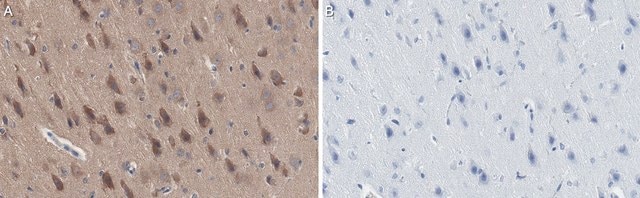 Anti-AIDA1 Antibody, clone 1A11