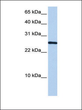 Anti-CIRBP antibody produced in rabbit affinity isolated antibody