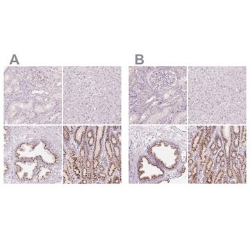 Anti-GALNT7 antibody produced in rabbit Prestige Antibodies&#174; Powered by Atlas Antibodies, affinity isolated antibody, buffered aqueous glycerol solution