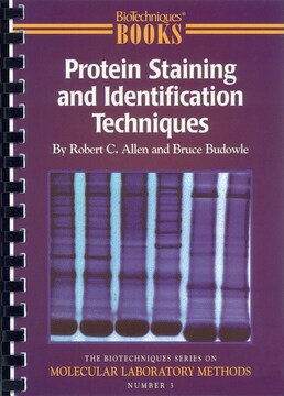 Protein Staining and Identification Techniques