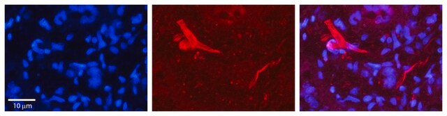 Anti-OGT affinity isolated antibody