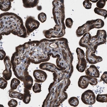 Anti-LYSMD3 antibody produced in rabbit Prestige Antibodies&#174; Powered by Atlas Antibodies, affinity isolated antibody, buffered aqueous glycerol solution