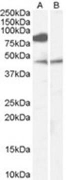 抗ZDHHC8抗体 affinity isolated antibody, buffered aqueous solution