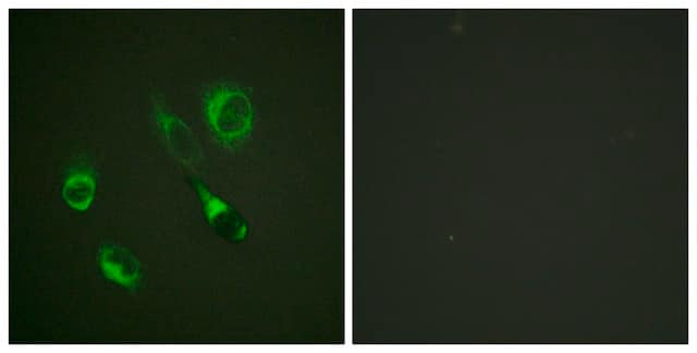 Anti-phospho-EPHA2/3/4 (pTyr588/596) antibody produced in rabbit affinity isolated antibody