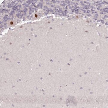 Anti-KBTBD6 antibody produced in rabbit Prestige Antibodies&#174; Powered by Atlas Antibodies, affinity isolated antibody, buffered aqueous glycerol solution