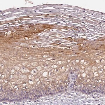 Anti-CCZ1 antibody produced in rabbit Prestige Antibodies&#174; Powered by Atlas Antibodies, affinity isolated antibody, buffered aqueous glycerol solution