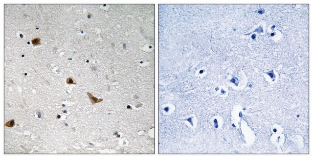 Anti-phospho-IKK-&#947; (pSer376) antibody produced in rabbit affinity isolated antibody