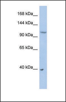 Anti-NEDD4L antibody produced in rabbit affinity isolated antibody