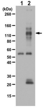 Anti-phospho TIE2/TEK Antibody (Tyr992) 0.25&#160;mg/mL, from rabbit