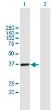 Anti-UPRT antibody produced in mouse purified immunoglobulin, buffered aqueous solution