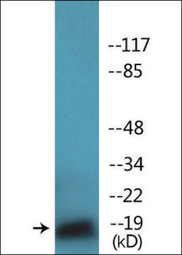 Anti-phospho-TEBP (pSer113) antibody produced in rabbit affinity isolated antibody