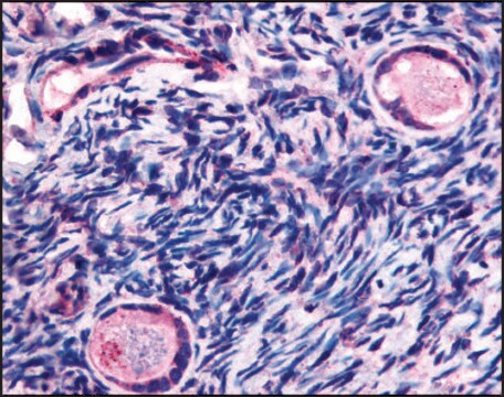 Anti-TMEM5 (AB2) antibody produced in rabbit affinity isolated antibody, buffered aqueous solution