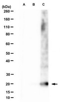 Anti-CMTM6 Antibody, clone RCT6