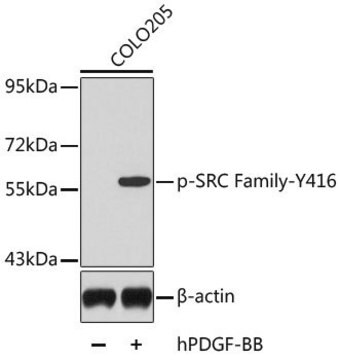 Anti-Phospho-SRC Family-Y416 antibody produced in rabbit