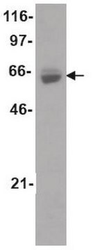 ChIPAb+ Estrogen Receptor &#945; - ChIP Validated Antibody and Primer Set ascites fluid, from mouse