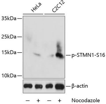 Anti-Phospho-STMN1-S16 antibody produced in rabbit