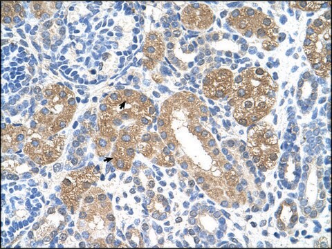 Anti-FAH IgG fraction of antiserum