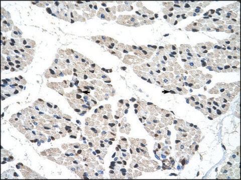 Anti-RALY antibody produced in rabbit IgG fraction of antiserum