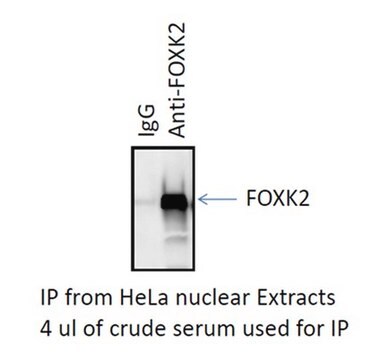 Anti-FOXK2 Antibody serum, from rabbit