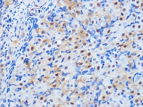 Anti-PP1 beta antibody produced in rabbit