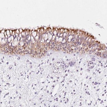 Anti-CARD16 antibody produced in rabbit Prestige Antibodies&#174; Powered by Atlas Antibodies, affinity isolated antibody, buffered aqueous glycerol solution