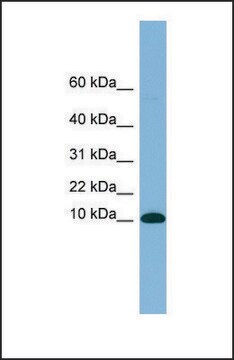 Anti-B2M, (N-terminal) antibody produced in rabbit affinity isolated antibody