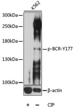 Anti-Phospho-BCR-Y177 antibody produced in rabbit