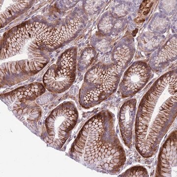 Anti-MRPL32 antibody produced in rabbit Prestige Antibodies&#174; Powered by Atlas Antibodies, affinity isolated antibody, buffered aqueous glycerol solution