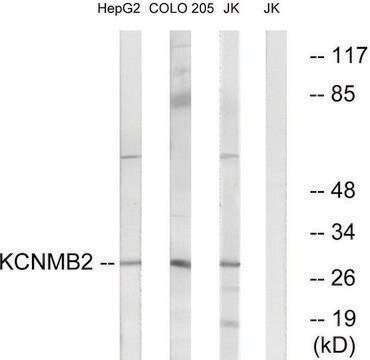 Anti-KCNMB2 antibody produced in rabbit affinity isolated antibody