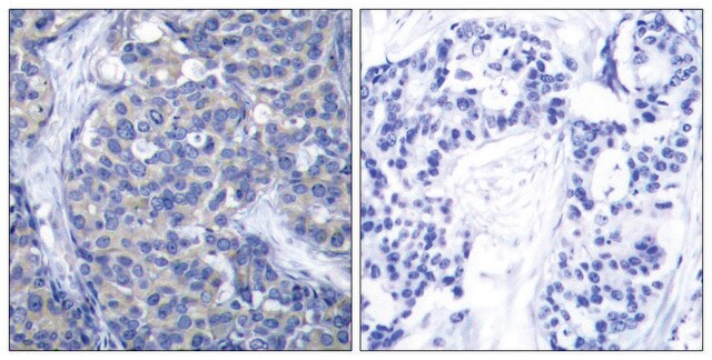 Anti-ZAP-70 antibody produced in rabbit affinity isolated antibody