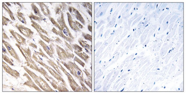 Anti-F13B antibody produced in rabbit affinity isolated antibody