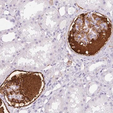 Anti-VTN antibody produced in rabbit Prestige Antibodies&#174; Powered by Atlas Antibodies, affinity isolated antibody, buffered aqueous glycerol solution