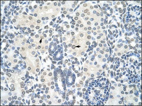 Anti-GIPC2 antibody produced in rabbit IgG fraction of antiserum