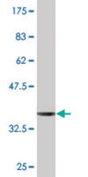 Monoclonal Anti-EVC antibody produced in mouse clone 3C4, purified immunoglobulin, buffered aqueous solution