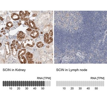 Anti-SCIN antibody produced in rabbit Prestige Antibodies&#174; Powered by Atlas Antibodies, affinity isolated antibody, buffered aqueous glycerol solution, Ab3