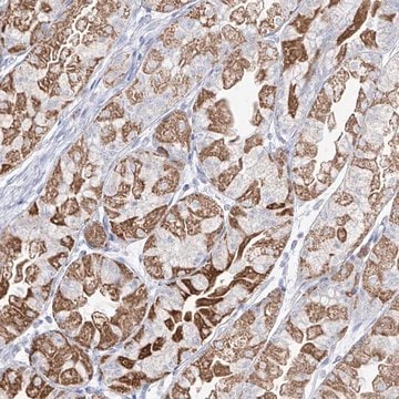 Anti-RCHY1 antibody produced in rabbit Prestige Antibodies&#174; Powered by Atlas Antibodies, affinity isolated antibody, buffered aqueous glycerol solution