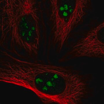 Anti-Vsx1 Antibody Produced In Rabbit Prestige Antibodies&#174; Powered by Atlas Antibodies, affinity isolated antibody, buffered aqueous glycerol solution