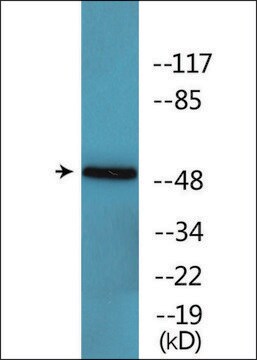 Anti-phospho-SRF (pSer77) antibody produced in rabbit affinity isolated antibody