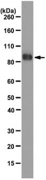 Anticuerpo anti-COMP (trombospondina-5), clon 484D1 clone 484D1, from rat