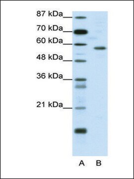 Anti-YY1 (AB1) antibody produced in rabbit affinity isolated antibody