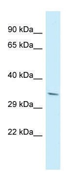 Anti-PDLIM7 (N-terminal) antibody produced in rabbit affinity isolated antibody