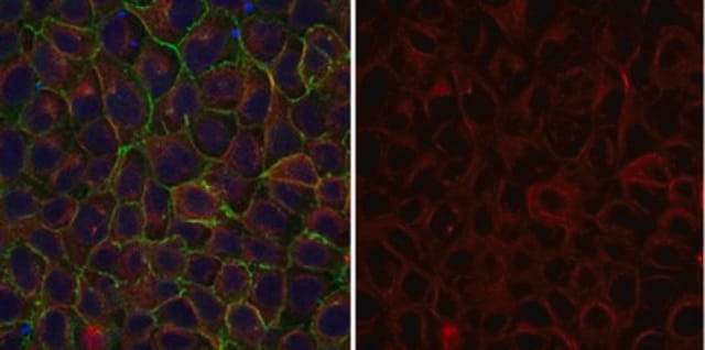 Anti-&#945;-Tubulin-Antikörper, Klon&nbsp;DM1A, Alexa-Fluor&#8482;-555-Konjugat clone DM1A, from mouse, ALEXA FLUOR&#8482; 555